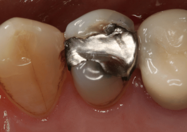 Before - Colindale Dental