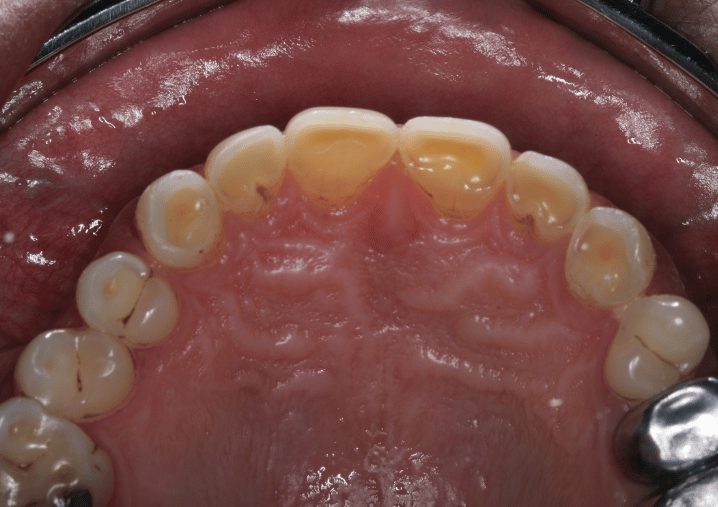 Before - Colindale Dental