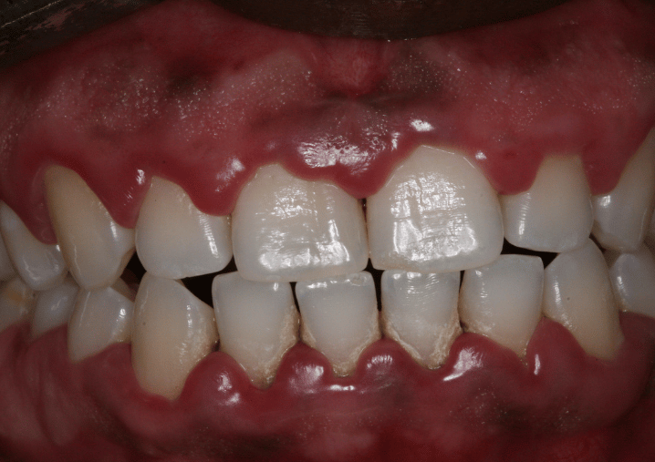 Before - Colindale Dental