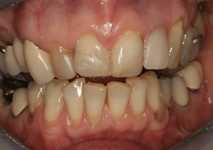 Before - Colindale Dental