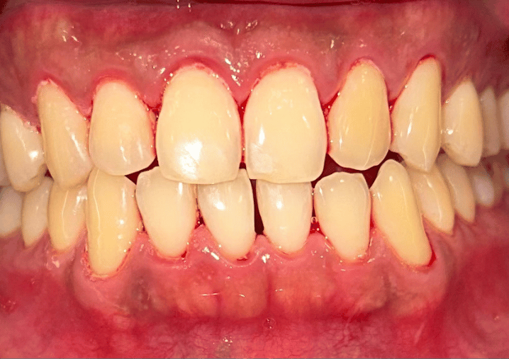 After - Colindale Dental