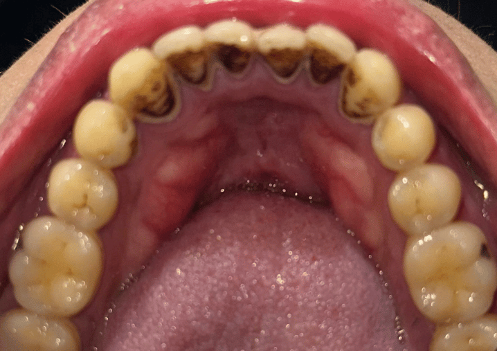 Before - Colindale Dental