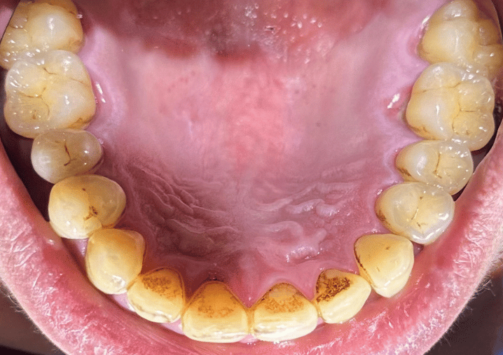 Before - Colindale Dental