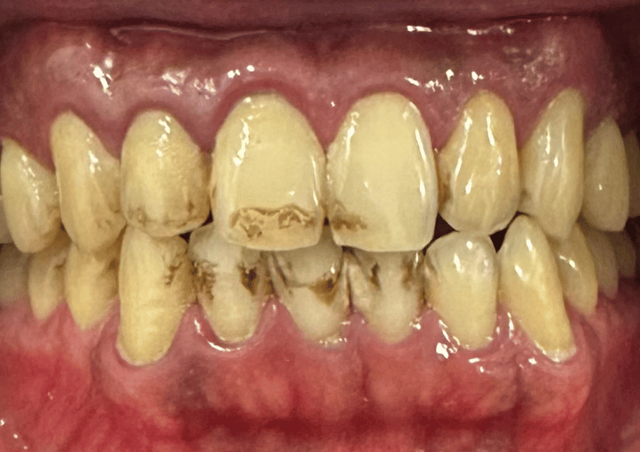 Before - Colindale Dental