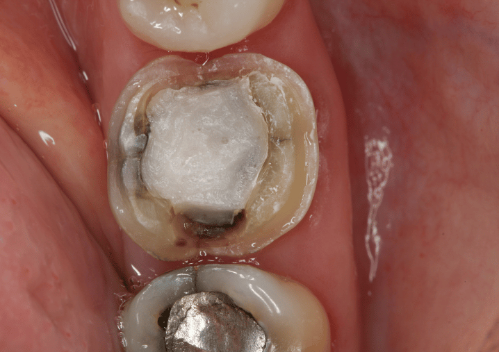 Before - Colindale Dental