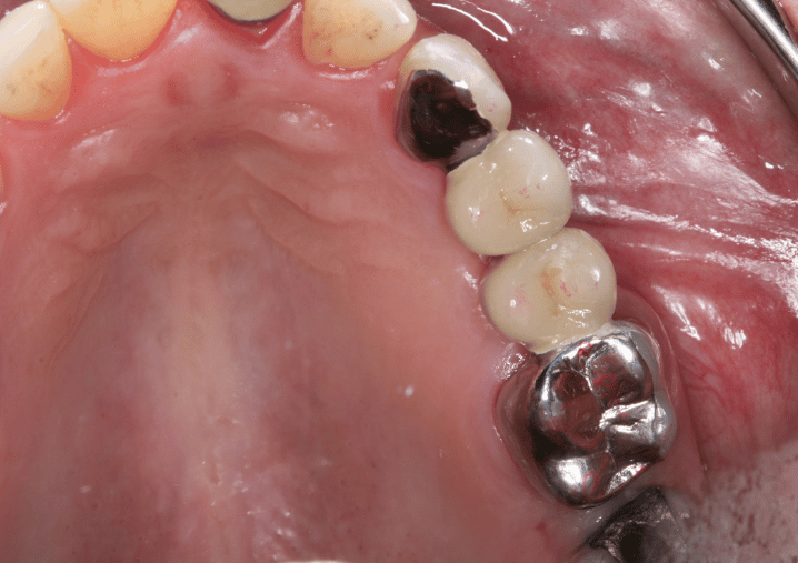 After - Colindale Dental