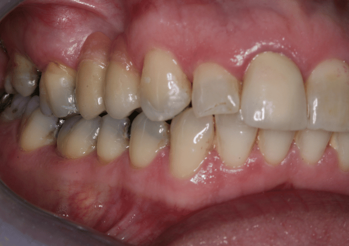 After - Colindale Dental