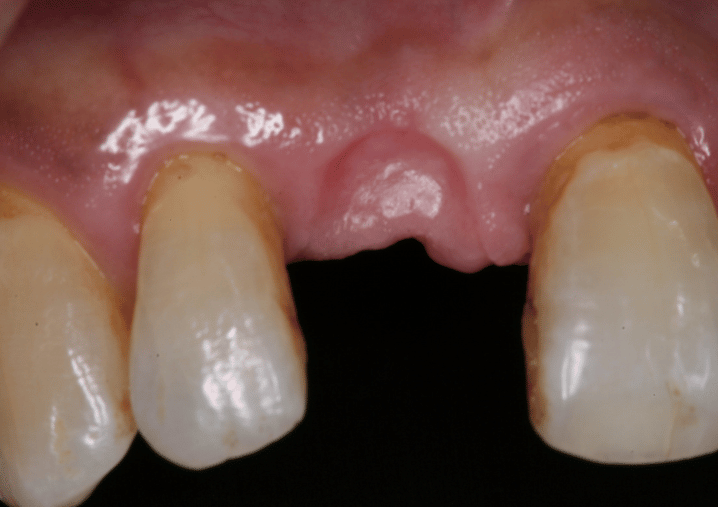 Before - Colindale Dental